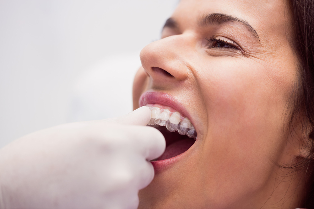 Dentista em Cuiabá 8 dentista ajudando o paciente do sexo feminino a usar aparelho
