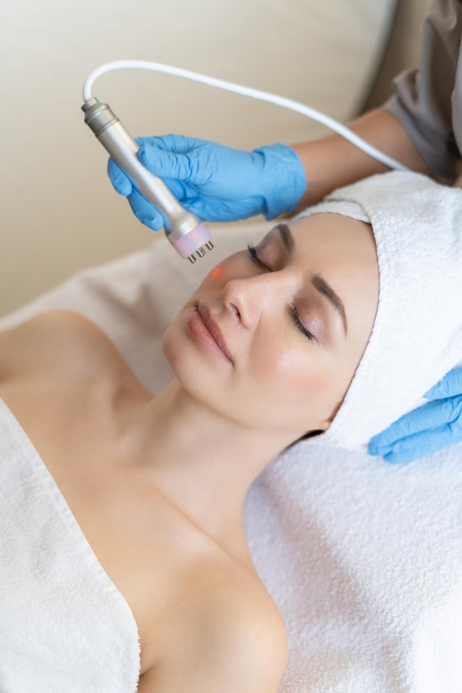 Lavieen Laser em Cuiabá 3 jovem mulher